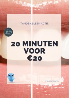 Tandenbleek actie